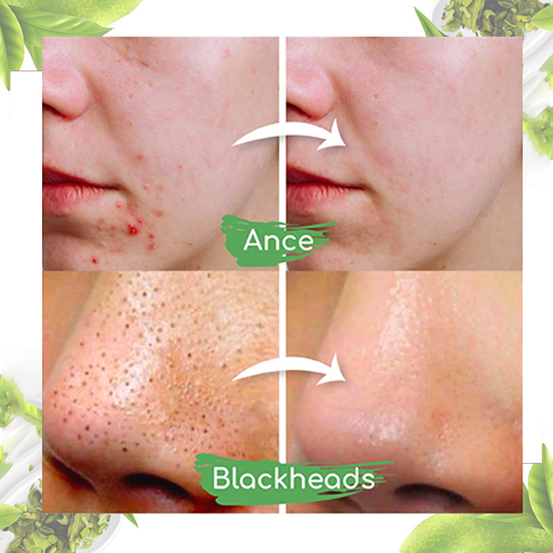 Seurico™ Green Tea Clay Mask Stick For Oil Control, Blackhead Reduction, and Pore Minimization