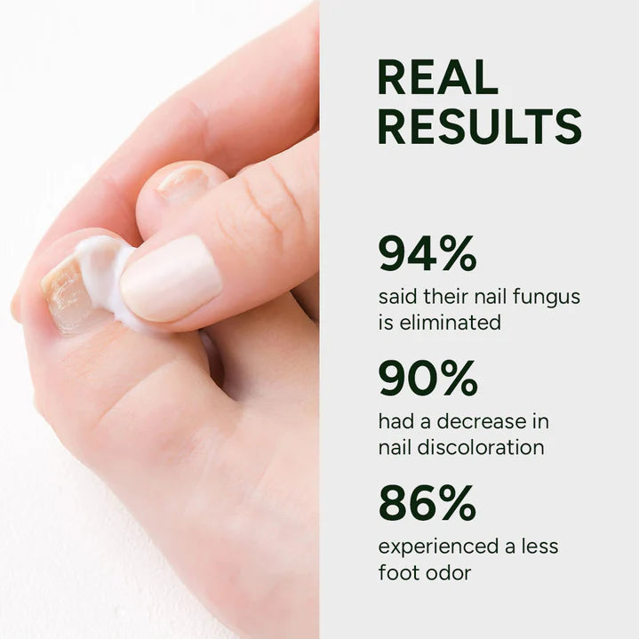 Nail Fungus Treatment Gel Limited Time 80%OFF 🔥LAST DAY⏰