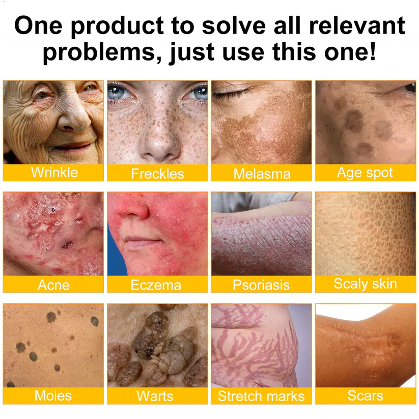 ✨FDA Approved: ODALIT® Bee Venom Skin Restoration Cream-🔥Limited Time 70%OFF 🔥