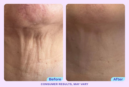 ODALIT Tighten & Lift Neck Cream-Limited Time 61%OFF 🔥