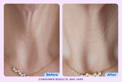 ODALIT Tighten & Lift Neck Cream-Limited Time 61%OFF 🔥