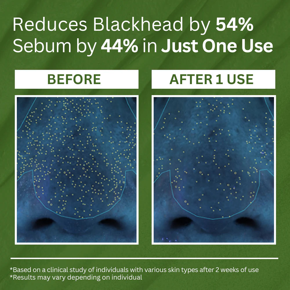 Holy Basil Sparking Bubble Mask-Limited Time 75%OFF 🔥LAST DAY⏰