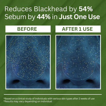 Holy Basil Sparking Bubble Mask-Limited Time 75%OFF 🔥LAST DAY⏰