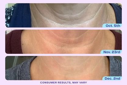 ODALIT Tighten & Lift Neck Cream-Limited Time 61%OFF 🔥