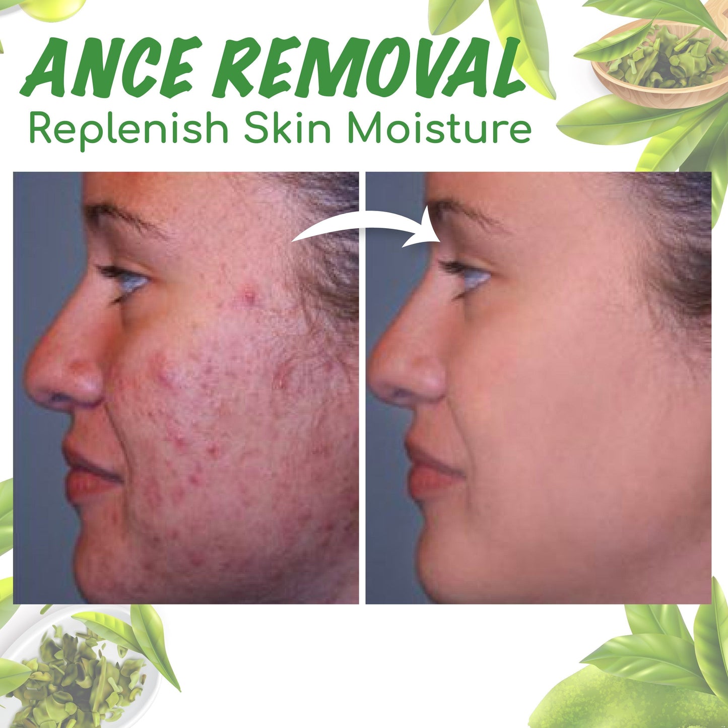 Seurico™ Green Tea Clay Mask Stick For Oil Control, Blackhead Reduction, and Pore Minimization