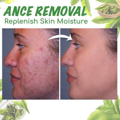 Seurico™ Green Tea Clay Mask Stick For Oil Control, Blackhead Reduction, and Pore Minimization