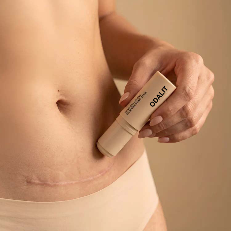 ODALIT™ Silicon ScarStick Limited Time 75%OFF Buy 1 Get 2 Free 🔥LAST DAY⏰