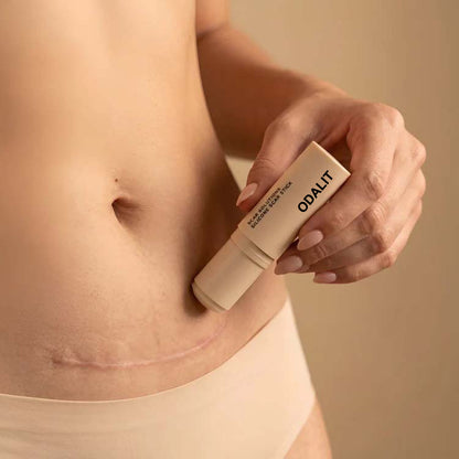 ODALIT™ Silicon ScarStick Limited Time 75%OFF Buy 1 Get 2 Free 🔥LAST DAY⏰