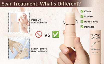 ODALIT™ Silicon ScarStick Limited Time 75%OFF Buy 1 Get 2 Free 🔥LAST DAY⏰