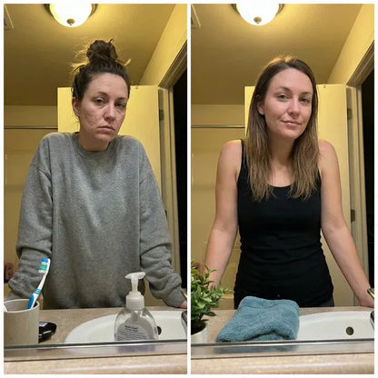 ODALIT™ Silicon ScarStick Limited Time 75%OFF Buy 1 Get 2 Free 🔥LAST DAY⏰