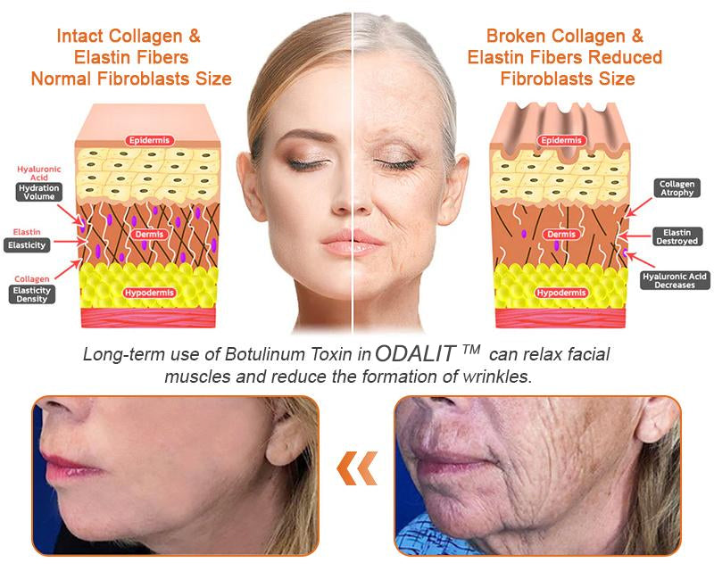 ✨FDA Approved: ODALIT® Bee Venom Skin Restoration Cream-🔥Limited Time 70%OFF 🔥