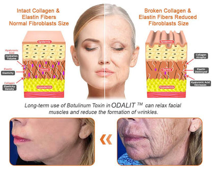 ✨FDA Approved: ODALIT® Bee Venom Skin Restoration Cream-🔥Limited Time 70%OFF 🔥